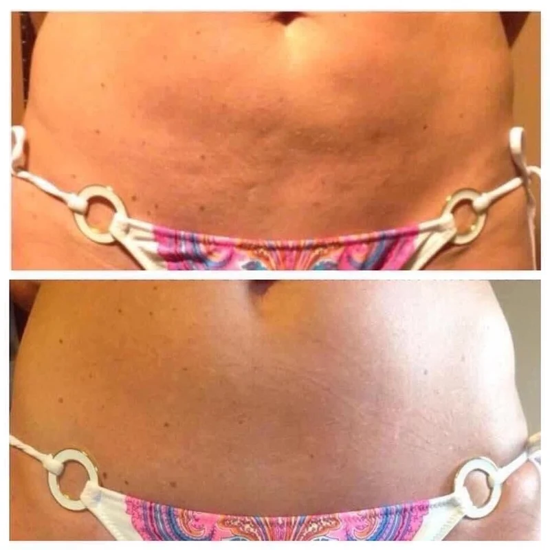 ageLOC® Dermatic Effects