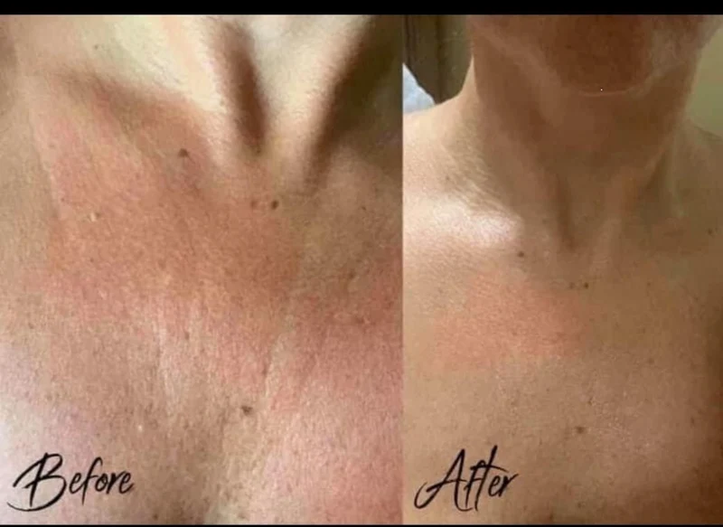 ageLOC® Dermatic Effects