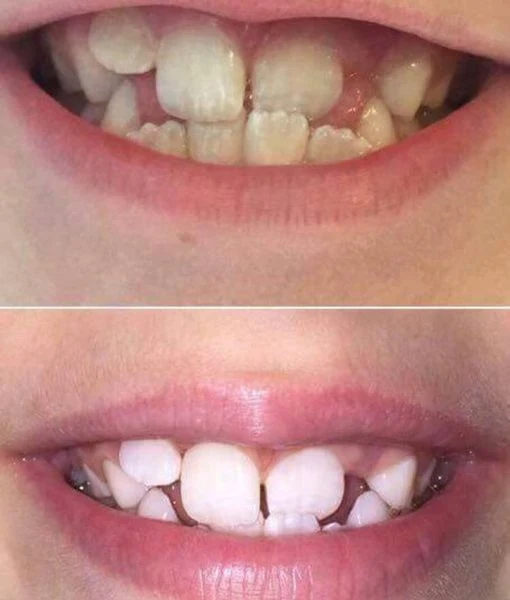 AP 24® Whitening Fluoride Toothpaste